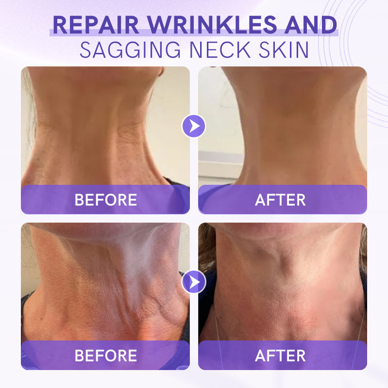 Furzero™ Aussie Tighten & Lift Neck Cream (✅TGA-CERTIFIED)🔥75% OFF🌸